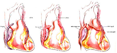 Professional Obesity Surgery Operations Accompanied by Expert Doctors at Ibni Sina Health.