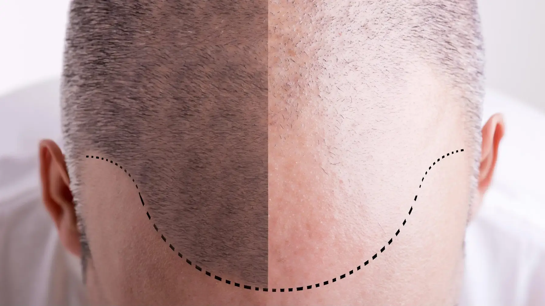 Professional Obesity Surgery Operations Accompanied by Expert Doctors at Ibni Sina Health.