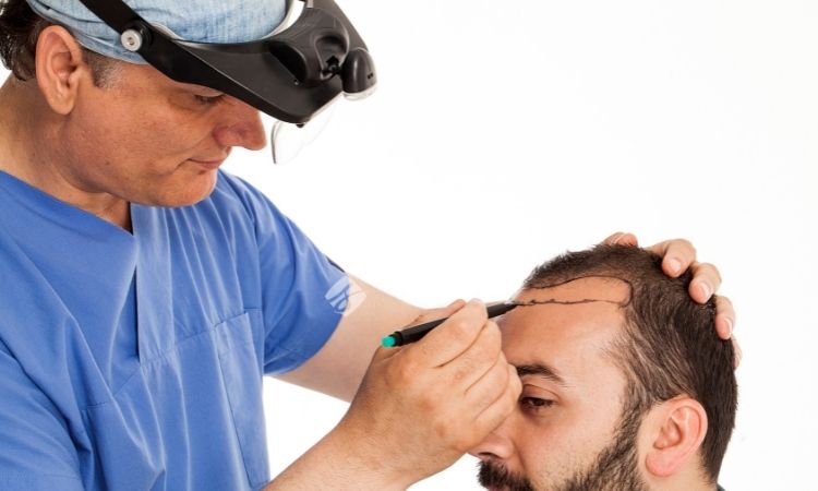 Unique FUE Method & Expert Hair Transplantation Professionals. Contact us to get natural and full hair.